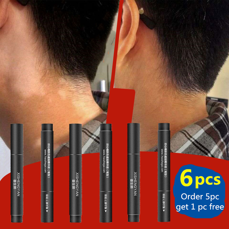 XISHENGYAN Vitiligo Concealer, – White Toner Transfer Paper Bewertung und Preis